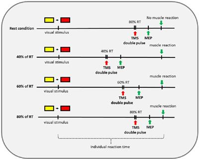 Influence of sports on cortical excitability in patients with spinal cord injury: a TMS study